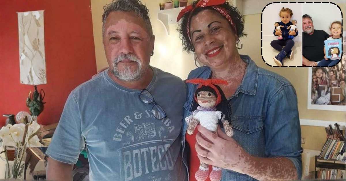 Grandfather With Vitiligo Knits Dolls for Children Who Look Just Like Them – A Story of Acceptance, Love, and the Healing Power of a Grandparent’s Heart